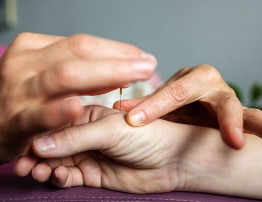 An acupuncture needles is inserted into acupoint LI4 in a patient's hand
